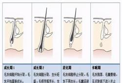 断发是什么原因造成的（头发易断脱发是什么原因）