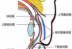 美瞳在眼睛里找不到了怎么办（隐形眼镜使用的正确方法）